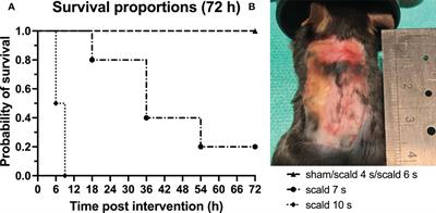 Murine scald models characterize the role of neutrophils and neutrophil extracellular traps in severe burns